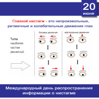 Непроизвольное движение глаз Непроизвольное движение глаз.